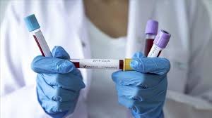 coronavirus4