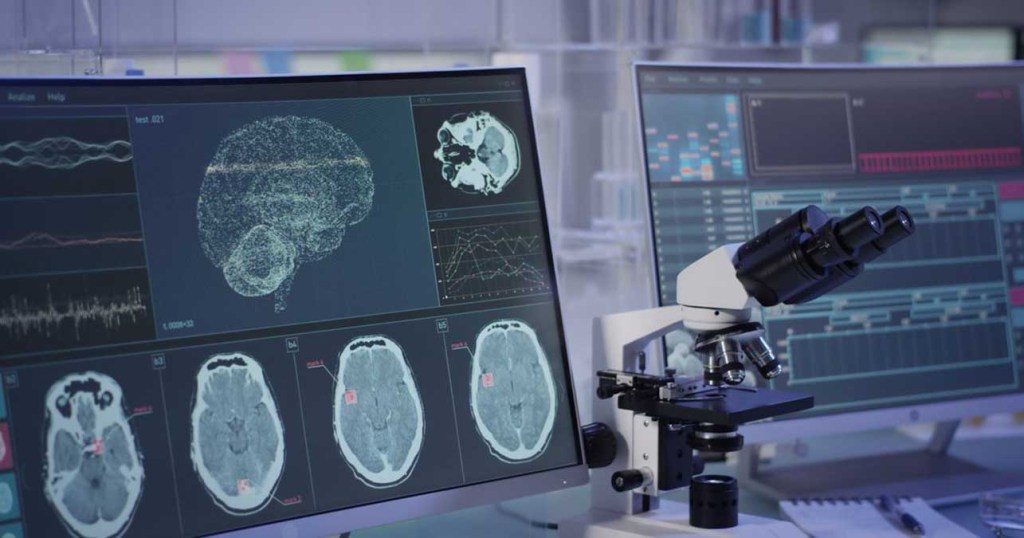 Neurodroits: Le Chili veut protéger le cerveau de ses citoyens contre les technologies