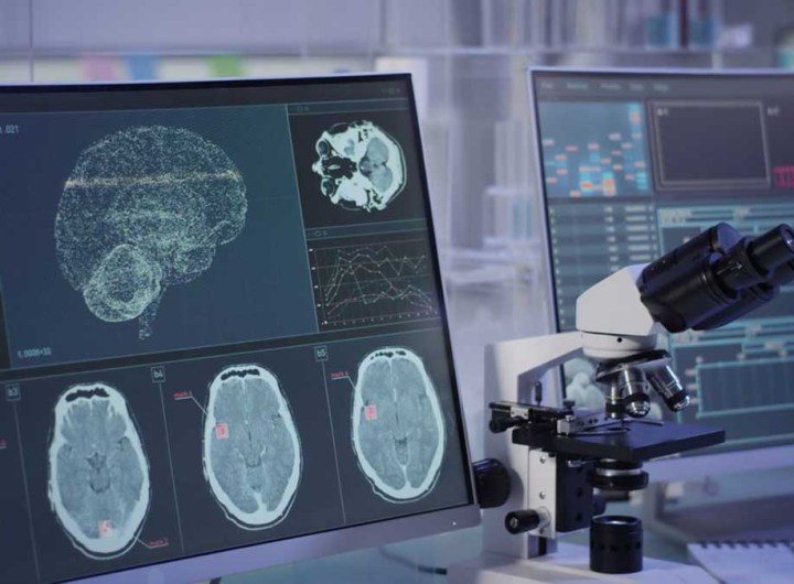 Neurodroits: Le Chili veut protéger le cerveau de ses citoyens contre les technologies