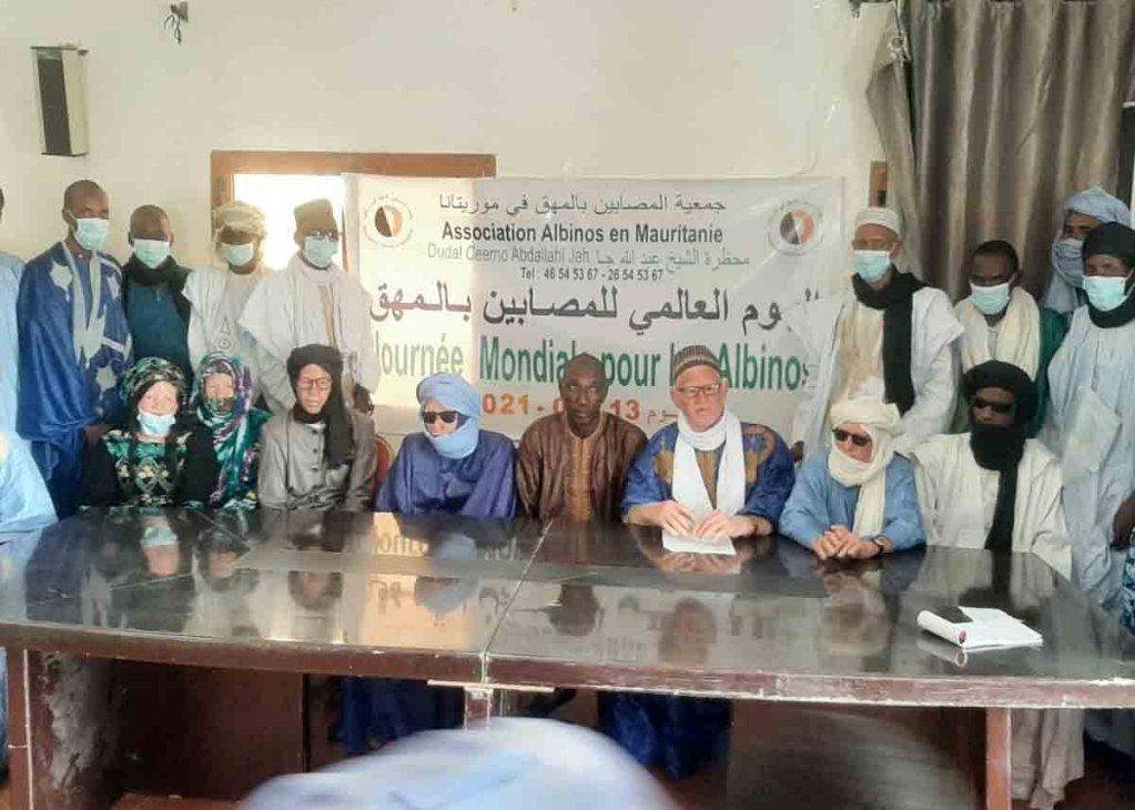La journée internationale de l’albinisme célébrée en Mauritanie