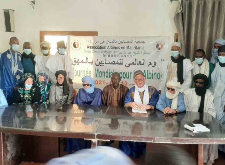 La journée internationale de l’albinisme célébrée en Mauritanie